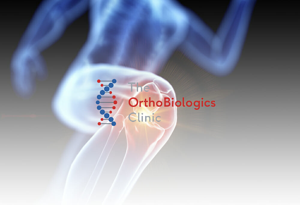 Orthobiologics Clinic Logo with image showing knee pain